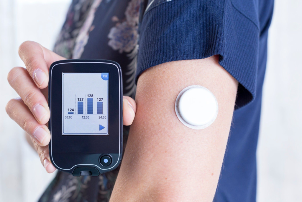 O dispositivo de monitoramento contínuo da glicose (MCG) representa uma das inovações mais significativas no manejo do diabetes nos últimos anos. Este dispositivo permite que pacientes com diabetes, sejam do tipo 1 ou tipo 2, acompanhem seus níveis de glicose em tempo real, promovendo um controle mais rigoroso e proativo da doença. Neste artigo, exploraremos o funcionamento do MCG, seus benefícios, desafios e como ele está transformando a vida dos pacientes diabéticos.