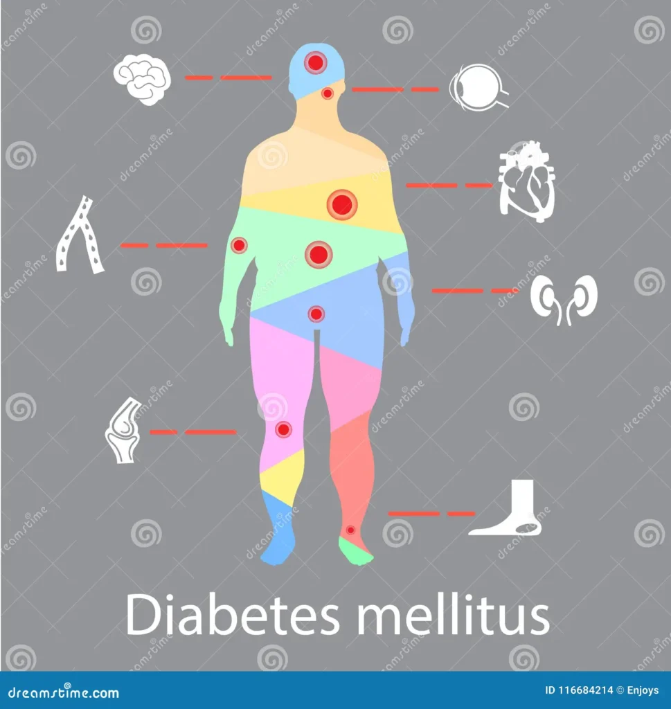 Complicações crônicas do diabetes